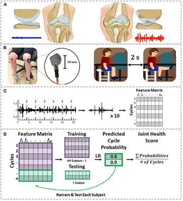 Knee Acoustic Emissions as a Digital Biomarker of Disease Status in Juvenile Idiopathic Arthritis